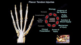 Flexor Tendon Injuries  Everything You Need To Know  Dr Nabil Ebraheim [upl. by Gamali]