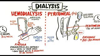 Failing Kidneys and Different Treatment Options [upl. by Friend]