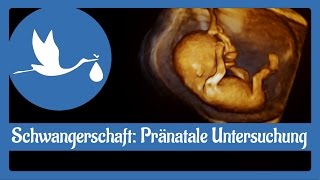 Schwangerschaft Pränatale Untersuchung [upl. by Hyacinthie]