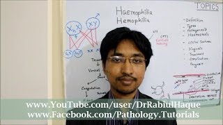 Hemophilia Types  hemophilia A Hemophilia B and Hemophilia C  Comparison  Genetics Hematology [upl. by Sdlonyer]