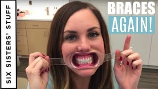 ADULT BRACES vs INVISALIGN  My Orthodontist Consultation [upl. by Brod]