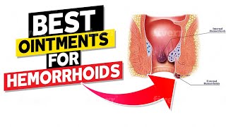 Best Ointments for Hemorrhoids [upl. by Pacorro]