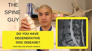 Lumbar Degenerative Disc Disease Part 1 Symptoms and Imaging [upl. by Bohner290]