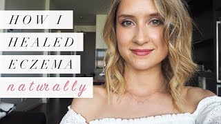 How I Healed Eczema Naturally  My Story [upl. by Azarcon527]