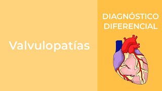 Diagnóstico Diferencial Valvulopatías [upl. by Sul908]