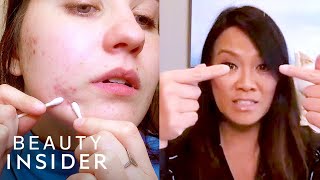 How To Pop A Pimple Yourself With Dr Pimple Popper  Beauty At Home [upl. by Silma]