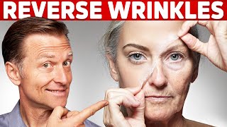 How To Reverse Wrinkles  – DrBerg on Anti Aging Hormones [upl. by Lissner]