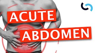 Acute Abdomen  Diagnosis and Management [upl. by Blanch212]