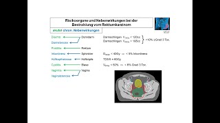 Darmkrebs Was wir dagegen tun können amp worauf wir achten müssen – Ursachen Symptome amp Therapie [upl. by Tnomed]