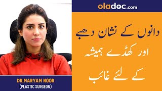 How To Get Rid Of Acne Scars Urdu Hindi  Danon Ke Nishan Khatam Karne Ki Tips  Remove Pimple Marks [upl. by Savell]