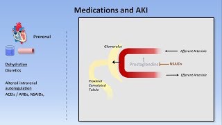 Acute Kidney Injury Part 13  Definitions and Etiologies [upl. by Chemarin630]