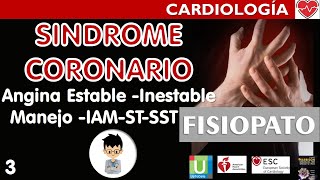 ANGINA ESTABLE INESTABLE MANEJO del IAM con y sin ELEVACIÓN ST Complicaciones Síndrome Coronario3 [upl. by Erehc900]