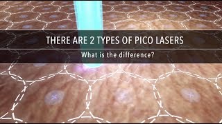 Why Are There Different Types of Pico Laser  Dr Kenneth Thean [upl. by Frederico909]