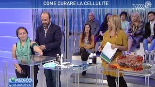 Come curare gambe gonfie ritenzione idrica e cellulite [upl. by Nuajed]