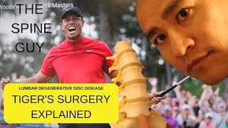 Lumbar Degenerative Disc Disease  Part 3 Surgical Treatments The quotTiger Woodsquot Surgery [upl. by Eramal672]