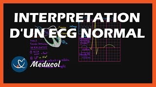 Electrocardiogramme ECG  interpretation dun ECG normal [upl. by Ytsrik929]