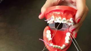 Placing a stainless steel ligature wire for Braces [upl. by Ainat92]