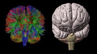 Diffusion Tensor Imaging DTI [upl. by Mirabelle]