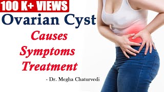 What You Need to Know About Ovarian Cysts [upl. by Gilud]