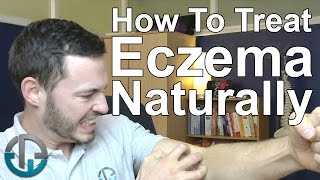 How To Treat Eczema Naturally [upl. by Pliner30]