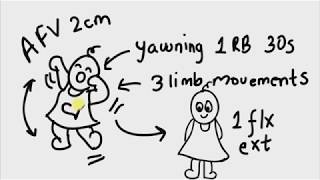 Biomedical Instrumentation and Measurement System  Basic Concepts [upl. by Leahplar]