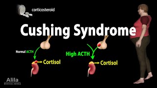 Cushing Syndrome Animation [upl. by Eisak24]