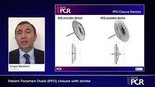 Patent Foramen Ovale PFO closure with stroke  EuroPCR 2021 [upl. by Ylrahc]