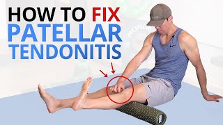 5 Exercises to Fix quotPatellar Tracking Disorderquot [upl. by Anid597]