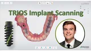 3shape TRIOS  Straumann Implant Scanning Workflow [upl. by Puklich544]