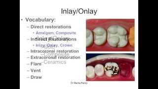 Introduction to inlaysonlays [upl. by Susumu792]