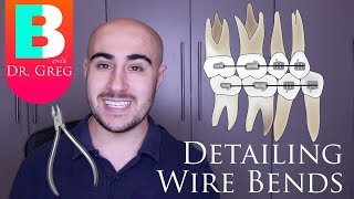 BRACES EXPLAINED Detailing Wire Bends [upl. by Eelynnhoj97]