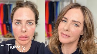 Makeup of the Week How to Cover Extreme Redness  Makeup Tutorial  Trinny [upl. by Arbmahs]