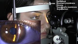 Ophthalmic Skills Series Part 15 [upl. by Fesuy]